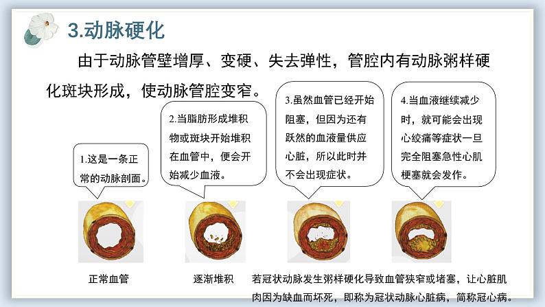 【核心素养目标】冀少版初中生物七年级下册《心脏和血管的保护》课件第8页