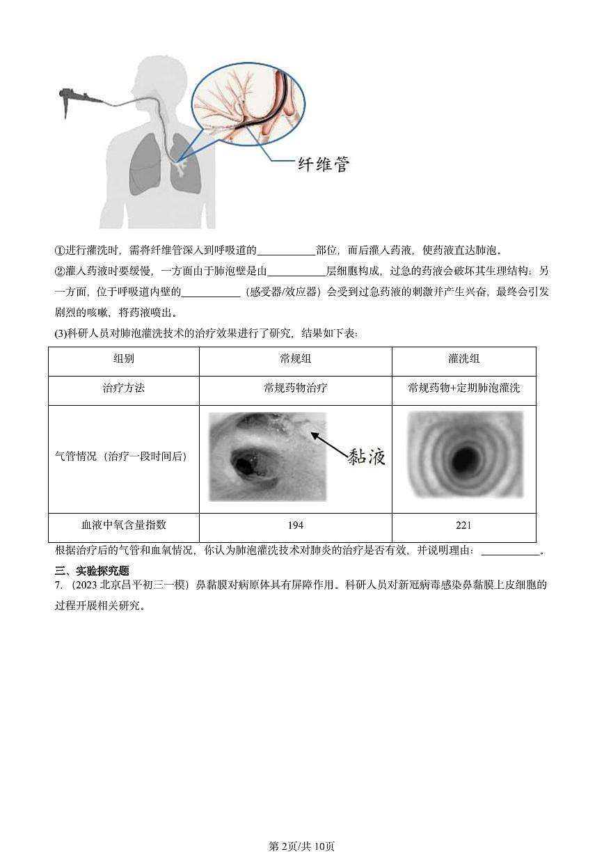 2022-2024北京初三中考一模生物汇编：免疫与计划免疫第2页