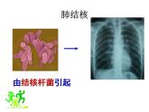 15.1 传染病-2024-2025学年八年级生物下册同步精品精品课件（北京版2024）