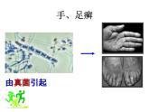 15.1 传染病-2024-2025学年八年级生物下册同步精品精品课件（北京版2024）