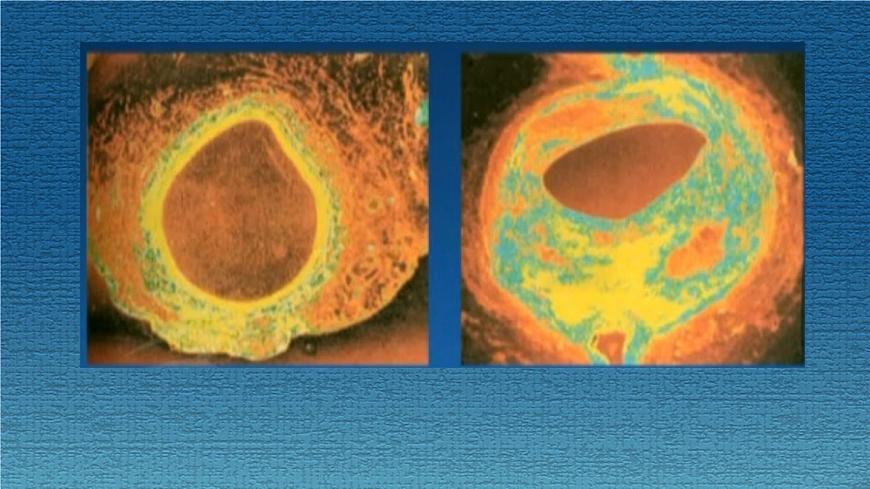 15.3 当代主要疾病及预防-2024-2025学年八年级生物下册课件（北京版2024）第4页