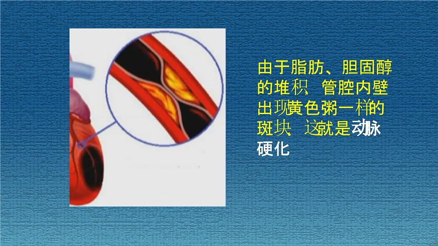 15.3 当代主要疾病及预防-2024-2025学年八年级生物下册课件（北京版2024）第5页