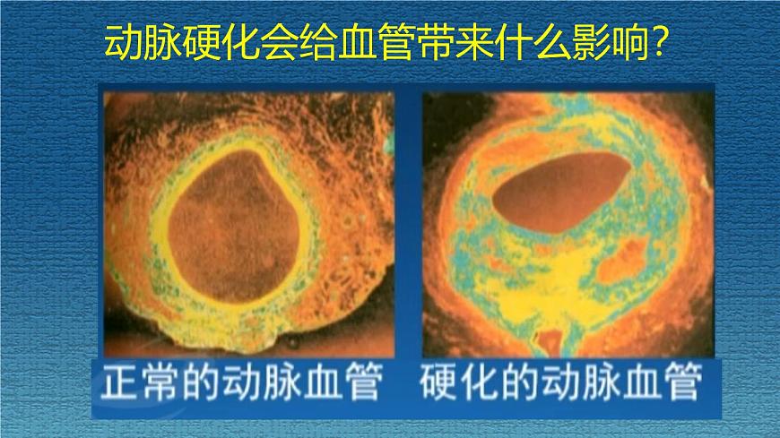 15.3 当代主要疾病及预防-2024-2025学年八年级生物下册课件（北京版2024）第6页