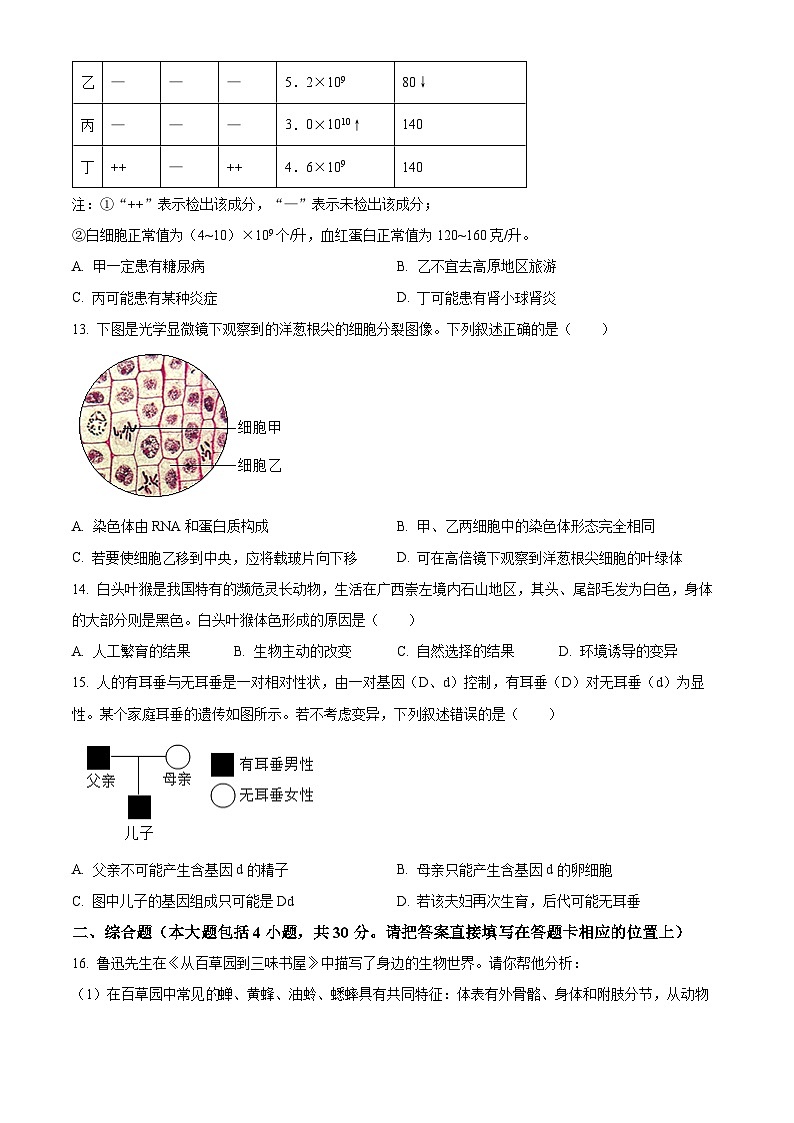 2025年广西柳州市中考二模生物试题（原卷版+解析版）第3页
