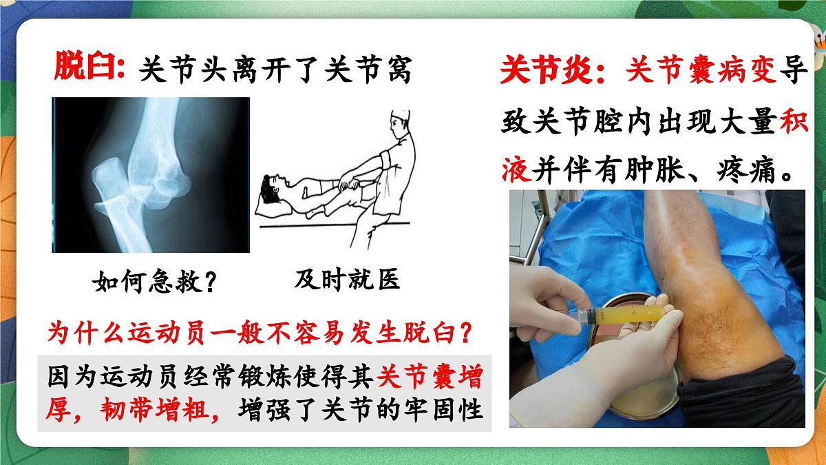 北师大版（2024新版）生物七年级下册期末复习课件：第十一章 人体的运动第6页
