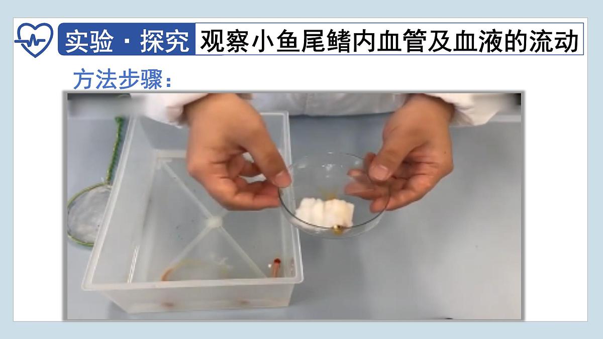4.4.2+血流的管道——血管  2025学年七年级生物下册人教版 课件第8页