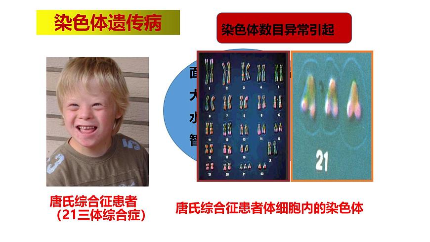 2025年春冀少版生物八年级下册上课课件 6.2.3 遗传病与优生第8页