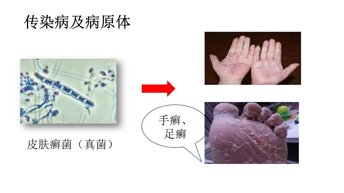 4.7.1传染病及其预防（课件）2025-2026学年人教版八年级生物上册第8页