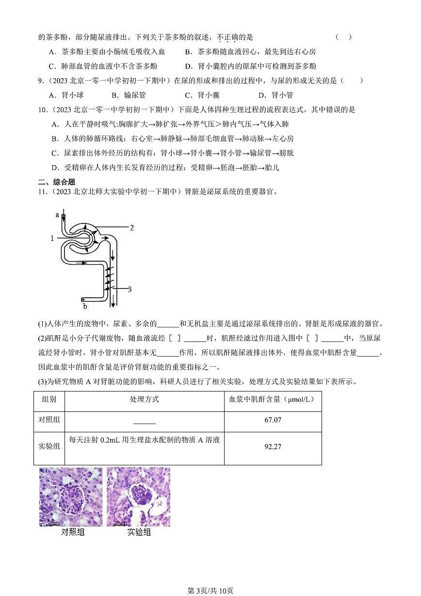 2023-2025北京重点校初一（下）期中生物汇编：尿液的形成和排出（京改版）第3页
