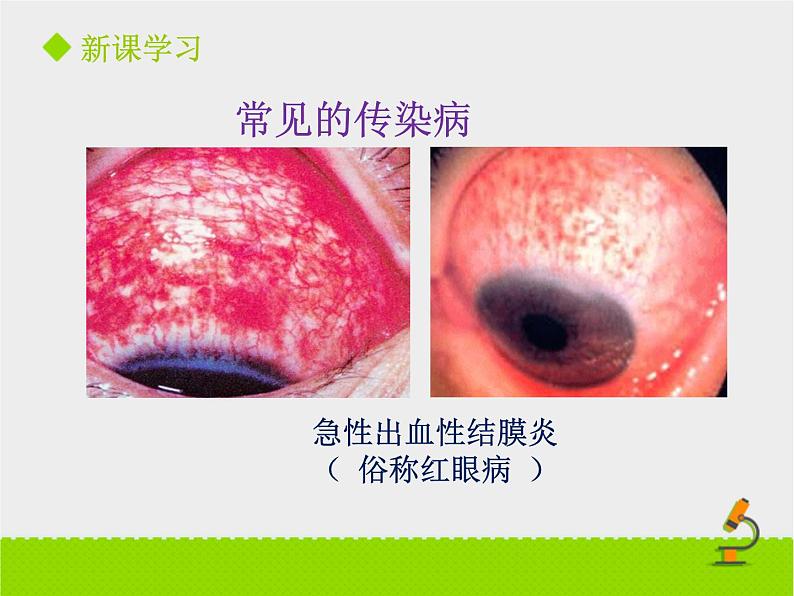 北京版生物八年级下册15.1《传染病》课件第二课时08