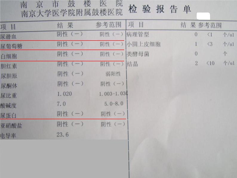 2020—2021学年人教版生物七年级下册 第四单元第五章人体内废物的排出 课件（24张PPT）第2页