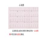 人教版八年级数学下册 19.1.2 第1课时　函数的图象 课件