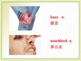 八年级英语人教版下册  Unit 1 What's the matter. Section B  课件
