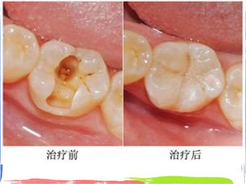 均衡营养——营养与健康 课件04