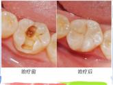 均衡营养——营养与健康 课件