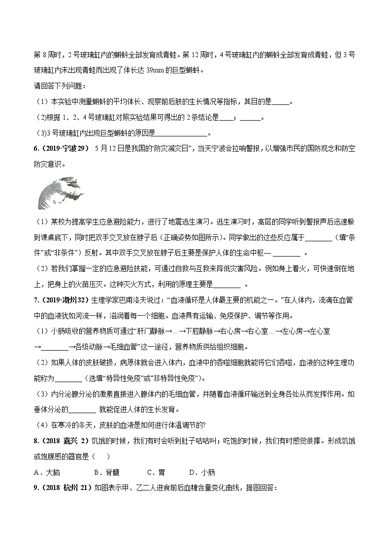 备战2022 中考科学 重难点练习 专题1.5 生命活动的调节03