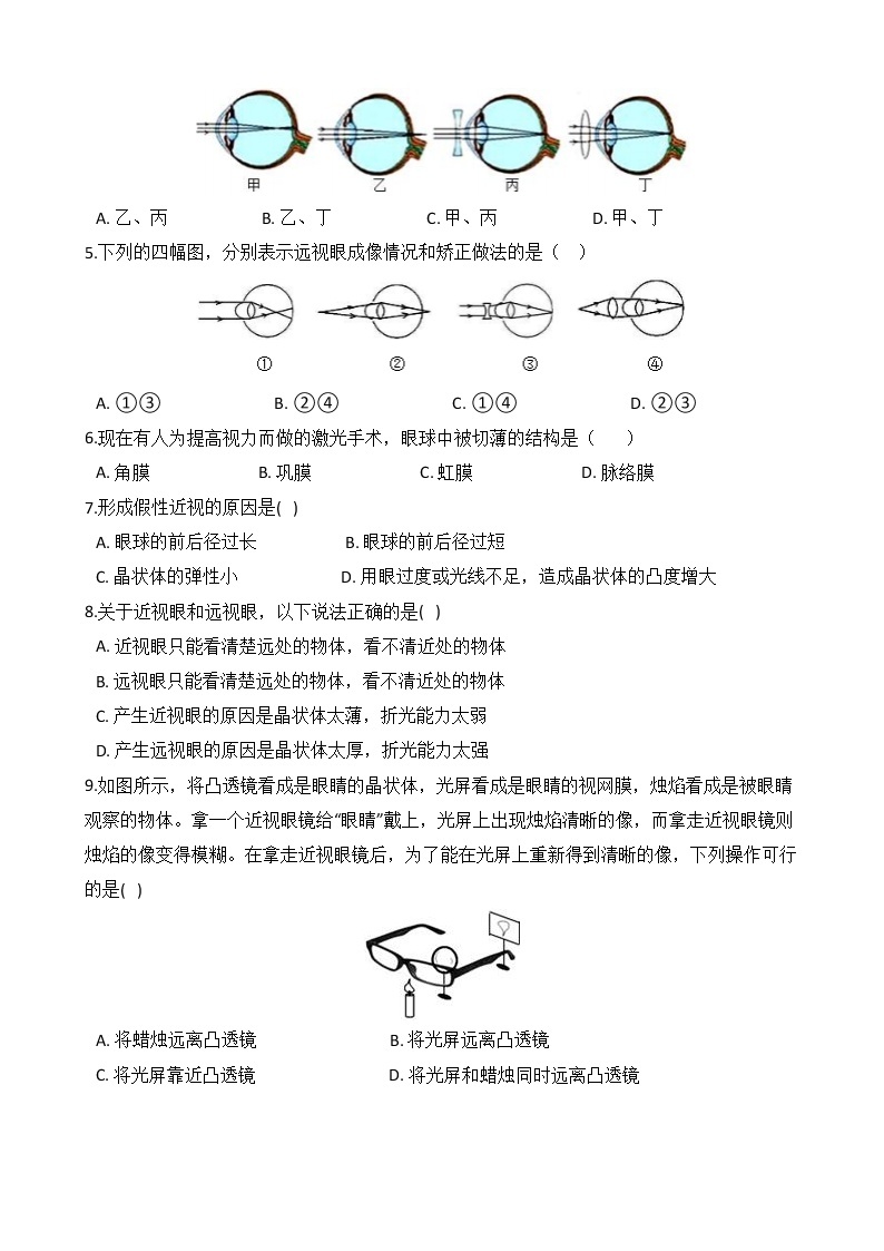 备战2022 浙教版科学 中考高频考点 加强练 第25讲 近视眼、远视眼02