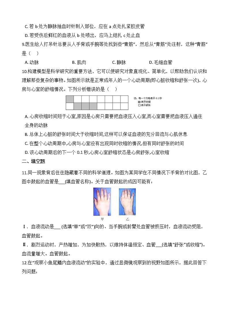 浙教版科学九年级上册 第4章 第3节 体内物质的运输（第2课时）课件PPT+教案+练习03