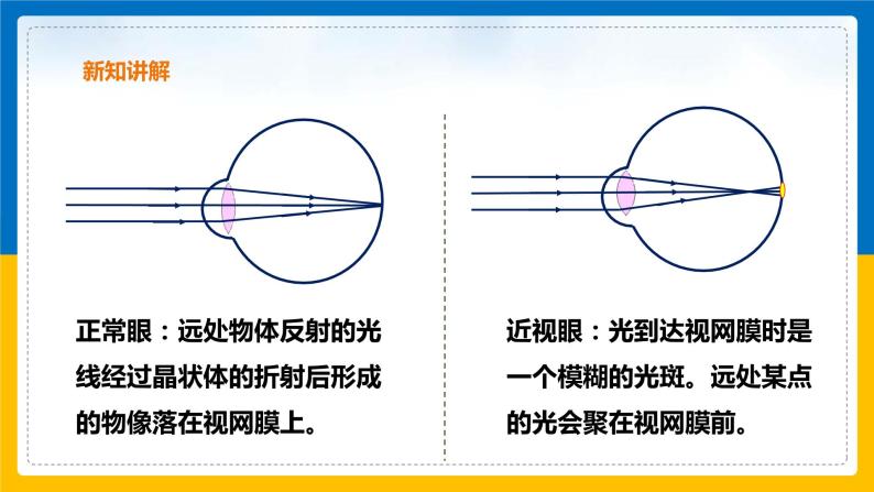 2.6 透镜和视觉（第2课时）（课件+教案+学案+练习）05