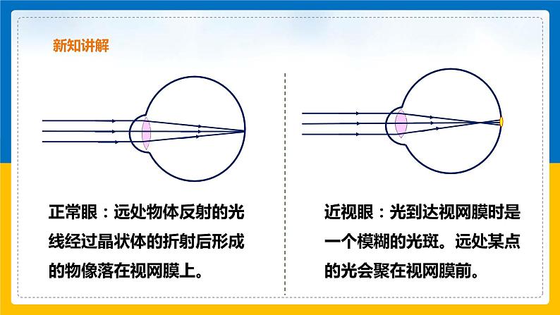 2.6 透镜和视觉（第2课时）（课件+教案+学案+练习）05