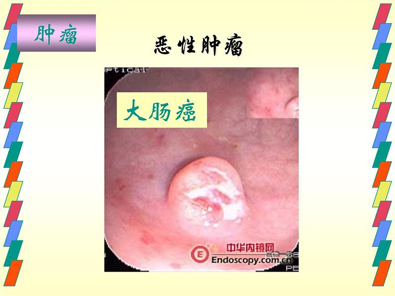 浙教版科学九下3.4《非传染性疾病》ppt课件（2）06