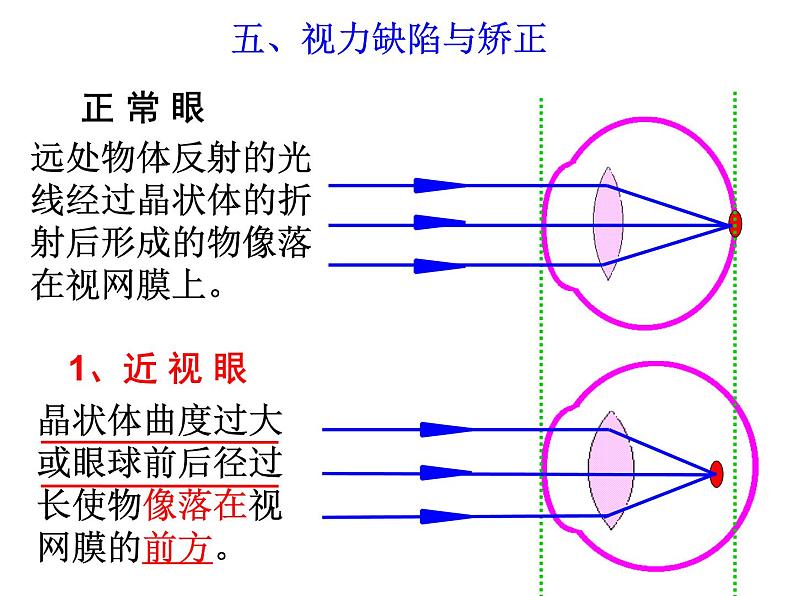 第6节 透镜和视觉（第4课时）第8页