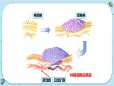 3.4  非传染性疾病（课件PPT）