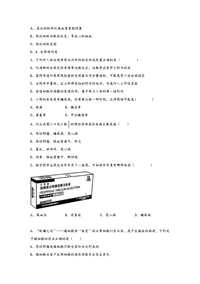 浙教版九年级下册科学讲练课堂3.4非传染性疾病(讲义)(原卷版+解析)03
