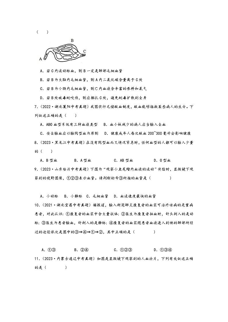 中考科学三年(2021-2023)真题分项汇编(浙江专用)专题45血管、血液与血型专题特训(原卷版+解析)第2页