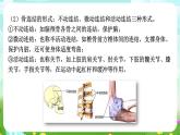 浙教版科學九下 3.5《人的運動系統(tǒng)和保健》第2課時 課件+教案+學案+素材
