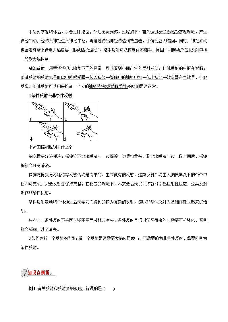 【精品讲义】浙教版 科学 8年级上册 3.3.2 神经调节——反射与反射弧（教师解析版+学生版）03