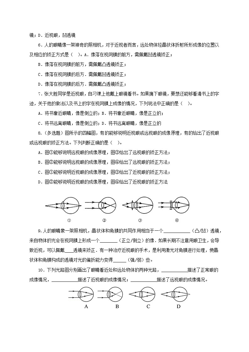 6.4  眼睛和眼镜 八下物理课件+练习（北师大版）02