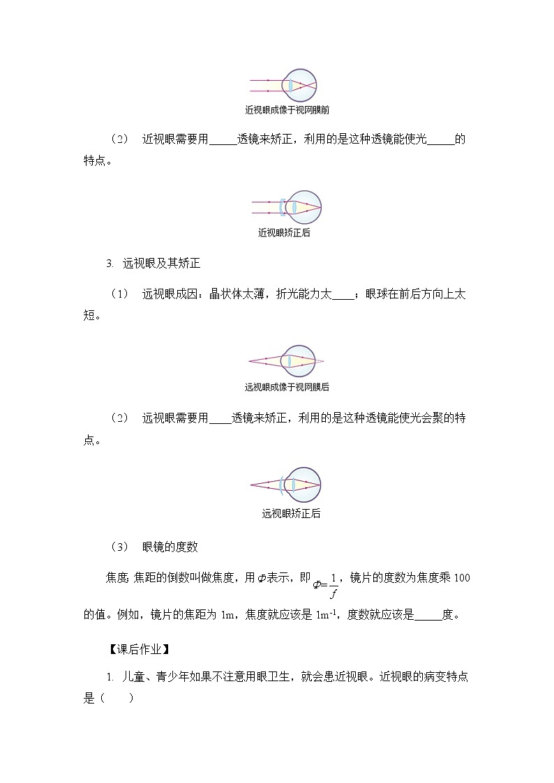 5.4眼睛和眼镜学习任务单 人教版物理八年级上册学案02