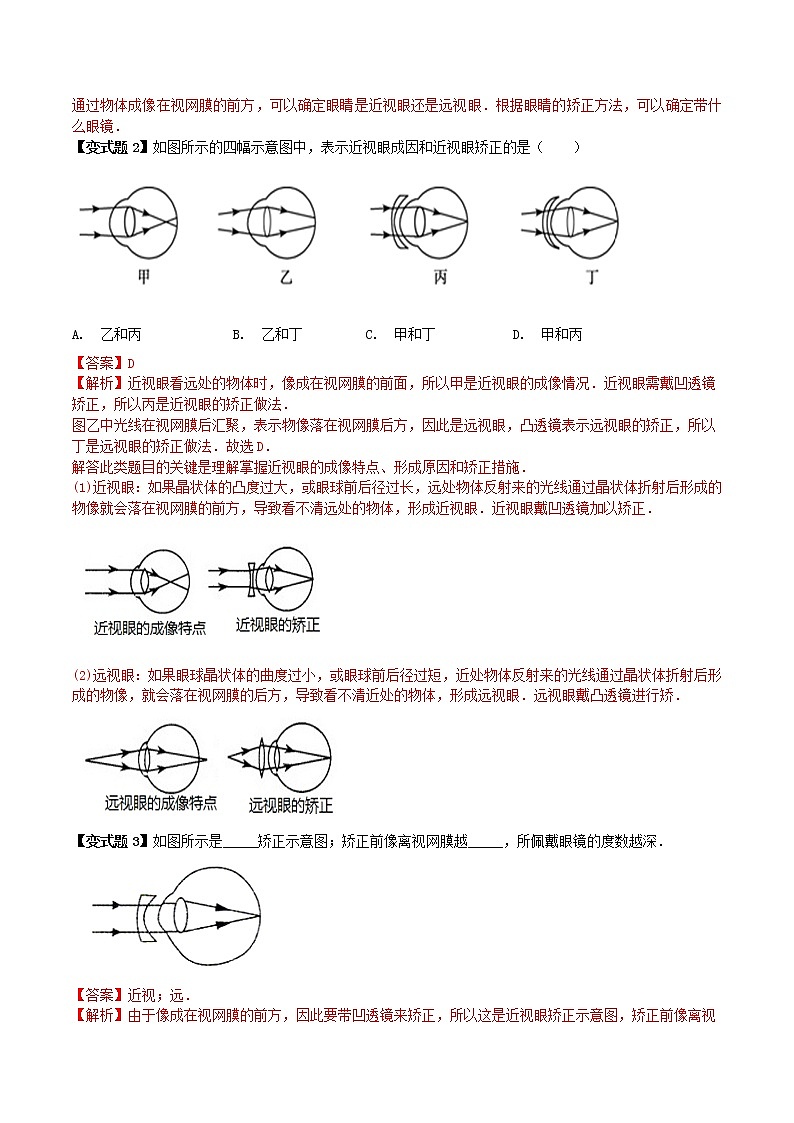 人教版八年级物理上册 第五章 《透镜及其应用》第4节 眼睛和眼镜（解析版+原卷版）期末复习试卷03