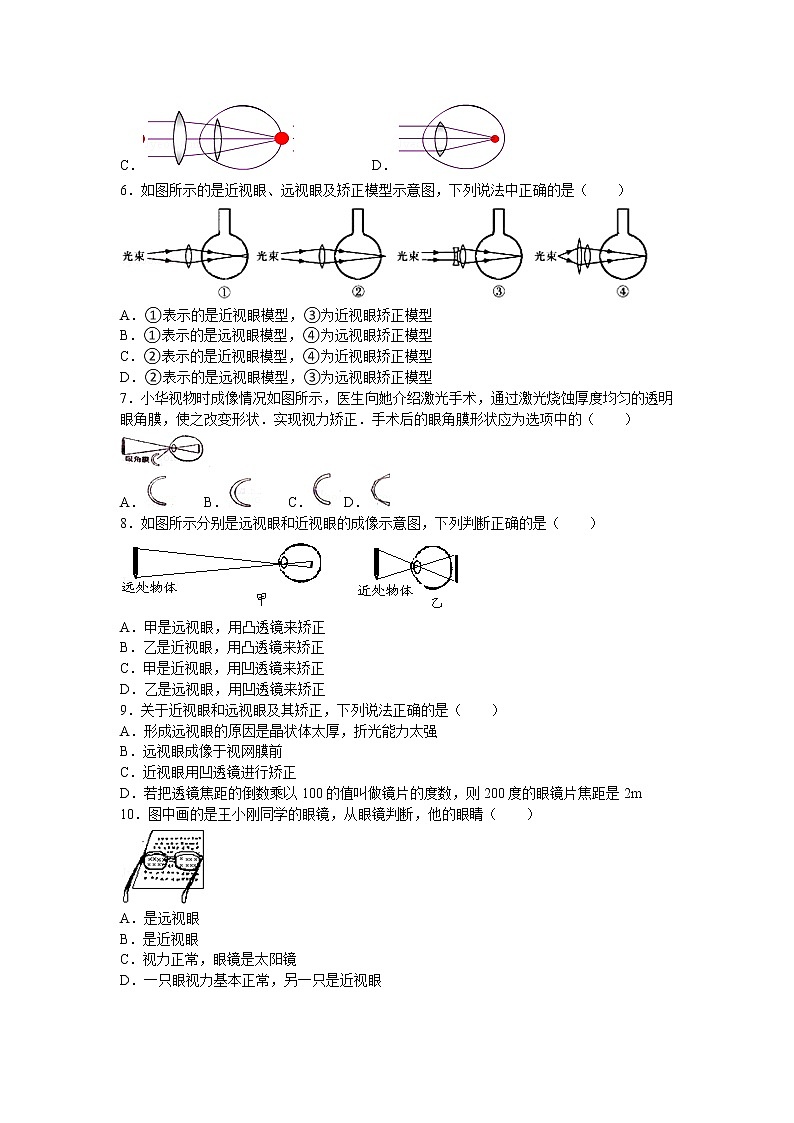 【同步练习】苏科版初二物理上册 第4章《光的折射 透镜》4.4 照相机与眼球 视力的矫正（含答案）02