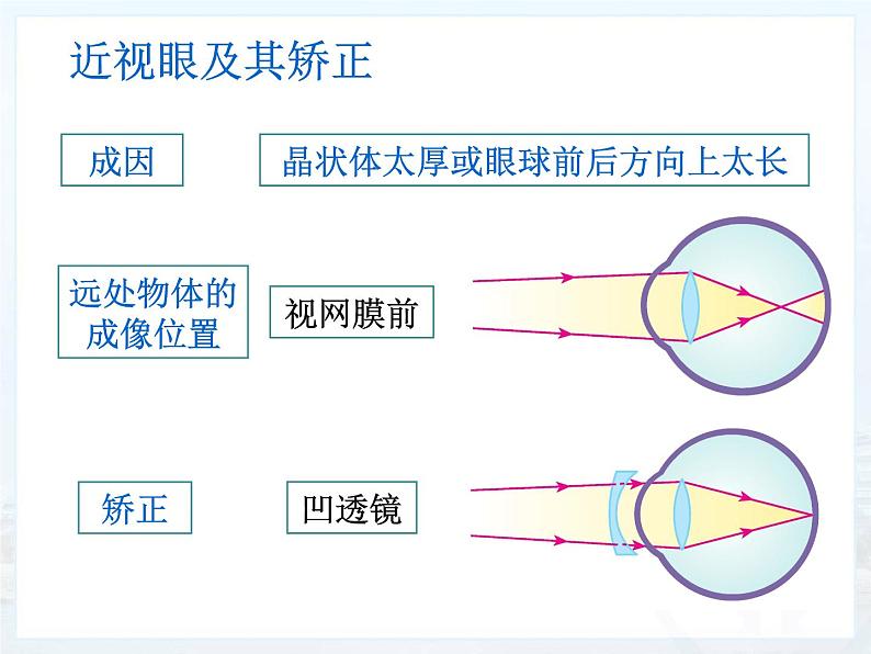 5.4  眼睛和眼镜（课件）2021-2022学年人教版物理八年级上册(共16张PPT)第8页