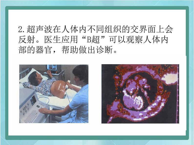 京改版八年级全册 物理 课件 1.7超声波及其应用（13张）第5页
