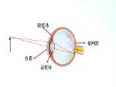 人教版物理八年级上册 5.4 眼睛和眼镜 课件+教学设计+同步练习