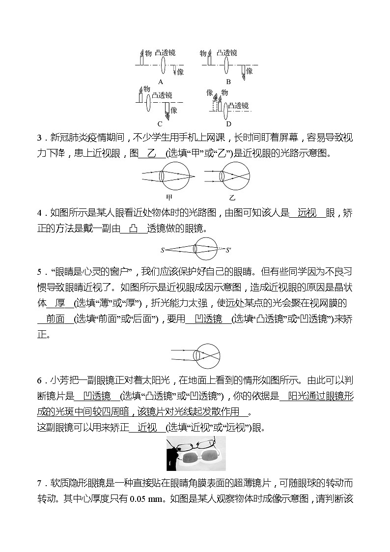 第五章  第4节  眼睛和眼镜 同步练习 （教师版）2022-2023 人教版物理 八年级上册第2页