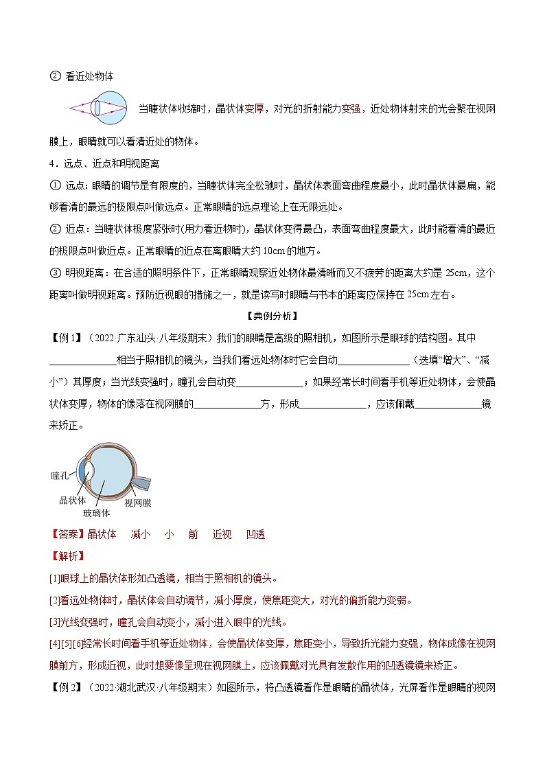 第21讲  眼睛和眼镜—2022-2023学年八年级上册物理精讲精练（人教版）02
