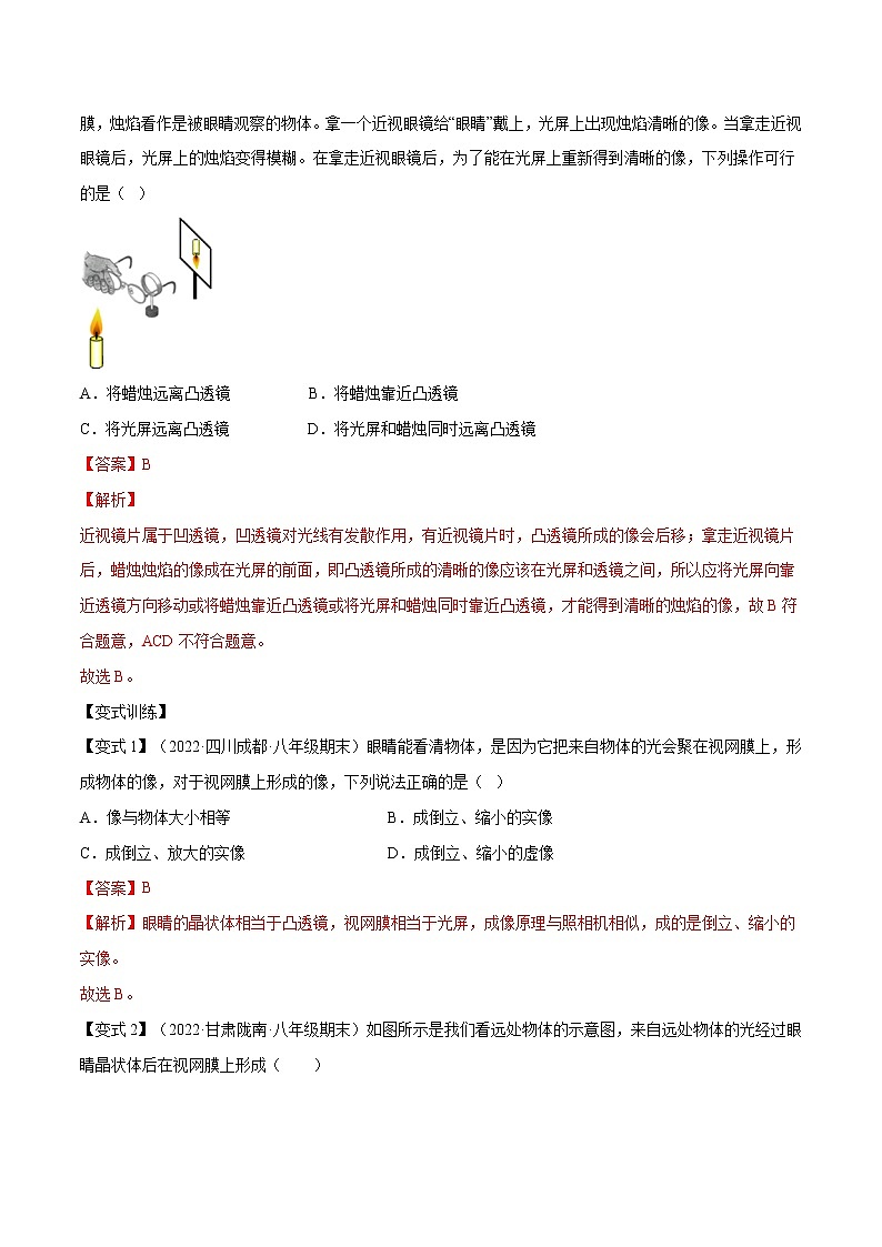 第21讲  眼睛和眼镜—2022-2023学年八年级上册物理精讲精练（人教版）03