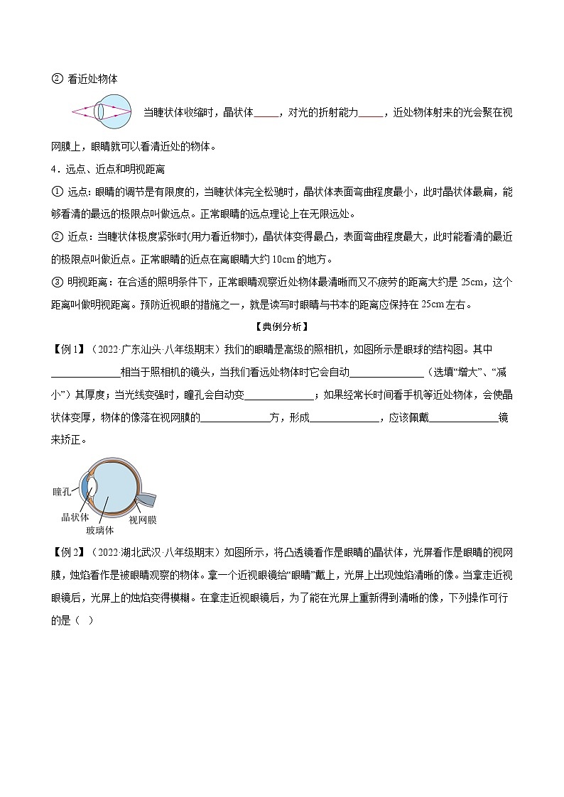 第21讲  眼睛和眼镜—2022-2023学年八年级上册物理精讲精练（人教版）02