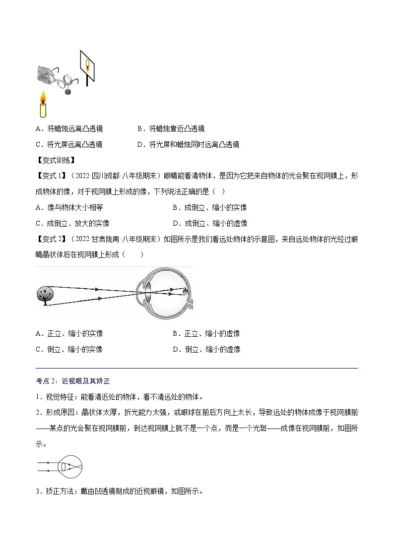 第21讲  眼睛和眼镜—2022-2023学年八年级上册物理精讲精练（人教版）03