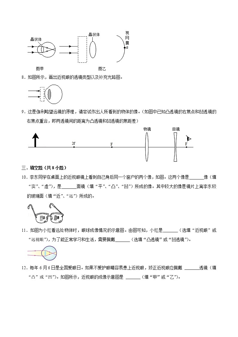 5.4眼睛和眼镜5.5显微镜和望远镜（练习）（原卷版）-八年级物理上册同步精品备课（人教版）第3页