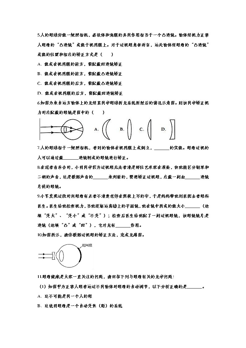 中考物理一轮复习强化训练——眼睛和眼镜 (含答案)第3页