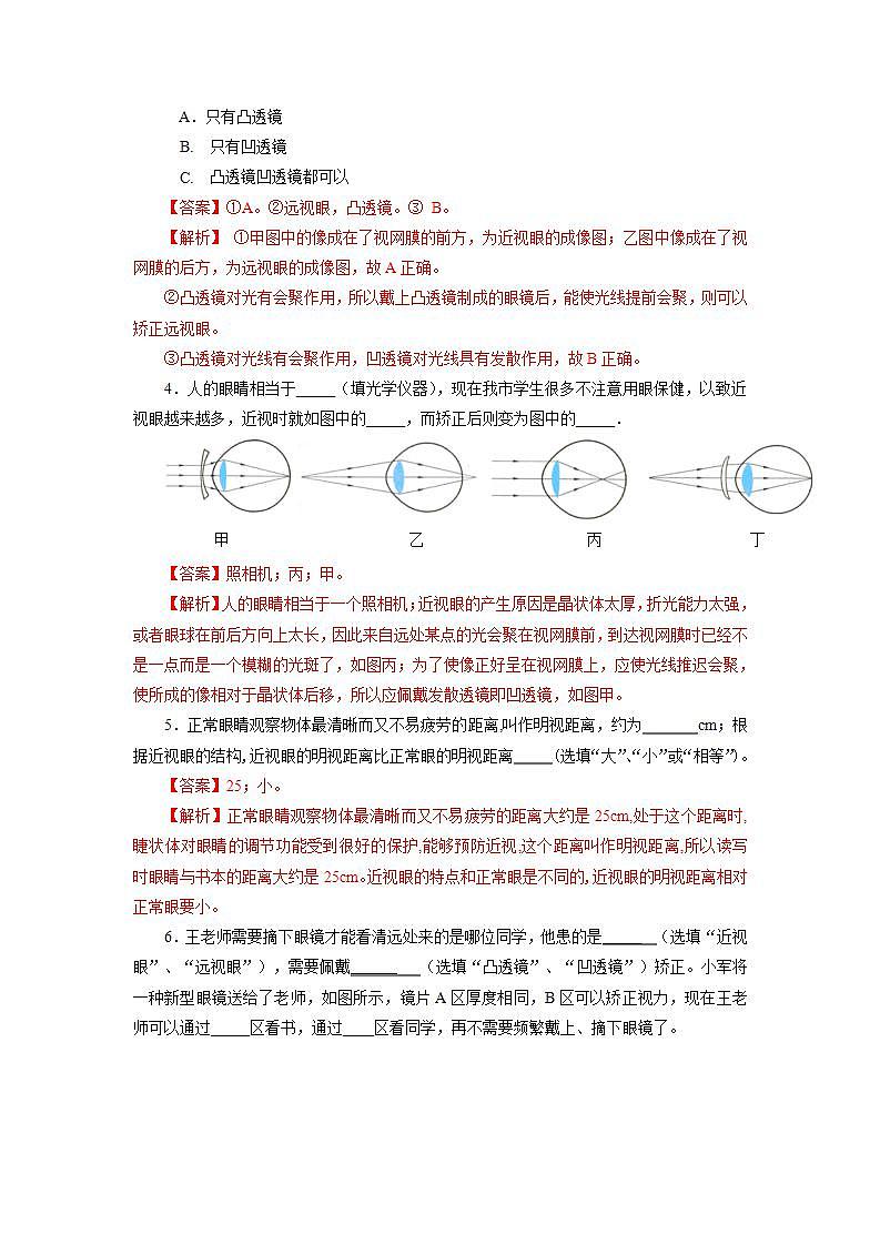 人教版八上物理 5.4 眼睛和眼镜 课件+内嵌式视频+练习（原卷版+解析版）02
