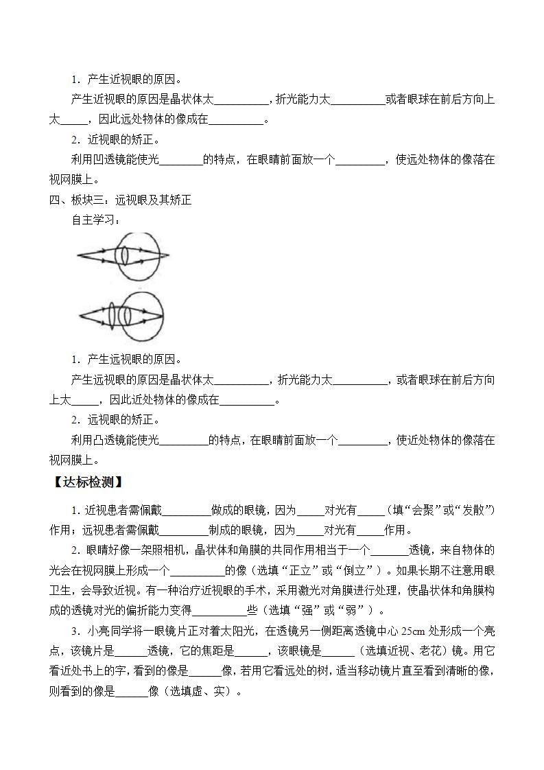 鲁教版（五四制）八年级上册 物理 学案 4.4眼睛和眼镜（无答案）02