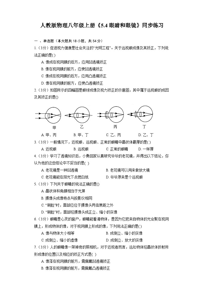 人教版物理八年级上册《5.4 眼睛和眼镜》同步练习第1页