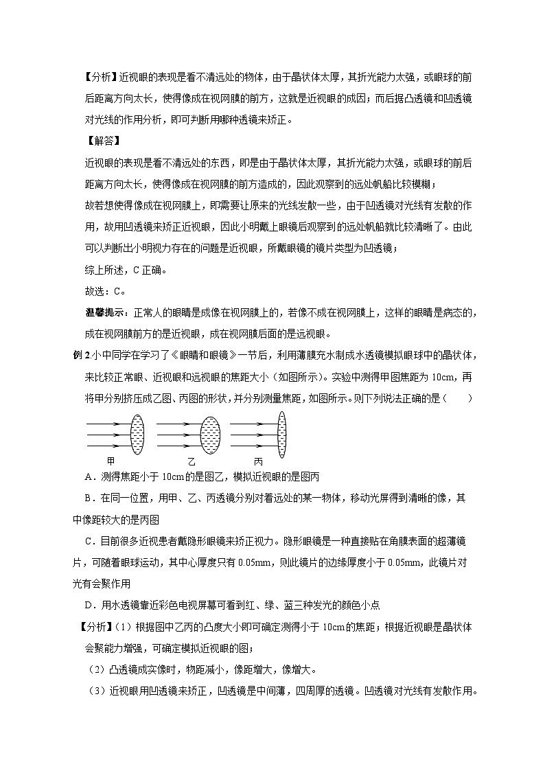 备考2024年中考物理重难点精讲精练：60-热点31 眼睛及视力矫正（精讲）第2页