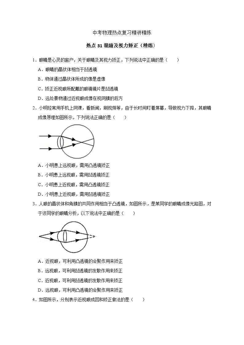 备考2024年中考物理重难点精讲精练：61-热点31 眼睛及视力矫正（精练）第1页